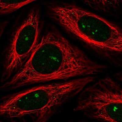 Immunocytochemistry/ Immunofluorescence: FBXW11 Antibody [NBP2-56451]