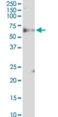 Western Blot: FBXW12 Antibody (1A9) [H00285231-M03]