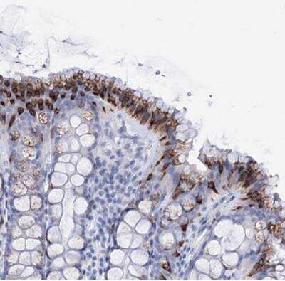 Immunohistochemistry: FBXW12 Antibody [NBP2-30761]