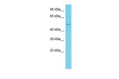 Western Blot: FBXW12 Antibody [NBP2-87436]