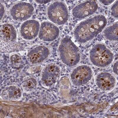 Immunohistochemistry-Paraffin: FBXW2 Antibody [NBP2-39089]