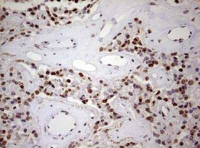 Immunohistochemistry: FBXW7/Cdc4 Antibody (OTI6F5) [NBP2-45623]