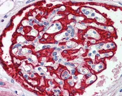 Immunohistochemistry: FBXW7/Cdc4 Antibody [NBP1-59631]