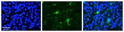 Immunohistochemistry: FBXW7/Cdc4 Antibody [NBP1-59631]