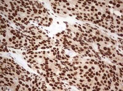 Immunohistochemistry: FBXW7/Cdc4 Antibody (OTI6F5) - Azide and BSA Free [NBP2-71995]