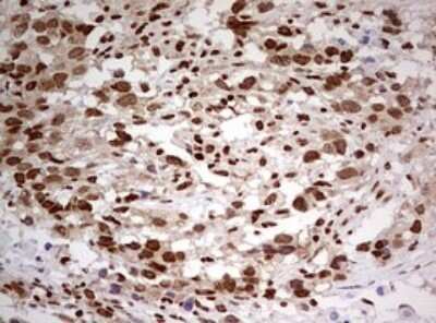 Immunohistochemistry: FBXW7/Cdc4 Antibody (OTI6F5) - Azide and BSA Free [NBP2-71995]
