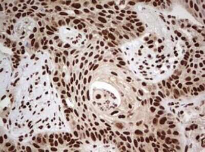 Immunohistochemistry: FBXW7/Cdc4 Antibody (OTI6F5) - Azide and BSA Free [NBP2-71995]