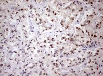 Immunohistochemistry: FBXW7/Cdc4 Antibody (OTI6F5) - Azide and BSA Free [NBP2-71995]