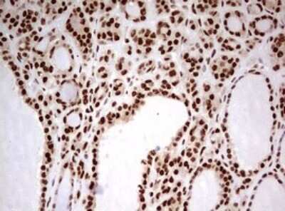Immunohistochemistry: FBXW7/Cdc4 Antibody (OTI6F5) - Azide and BSA Free [NBP2-71995]