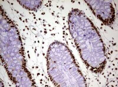 Immunohistochemistry: FBXW7/Cdc4 Antibody (OTI6F5) - Azide and BSA Free [NBP2-71995]