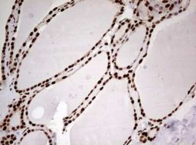 Immunohistochemistry: FBXW7/Cdc4 Antibody (OTI6F5) - Azide and BSA Free [NBP2-71995]