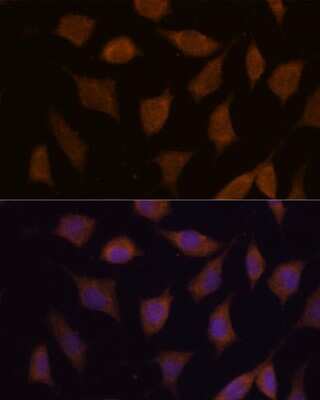 Immunocytochemistry/ Immunofluorescence: FBXW8 Antibody - Azide and BSA Free [NBP2-94072]