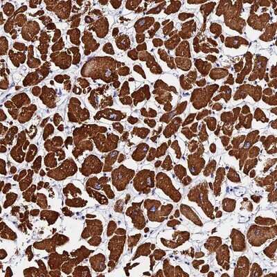 Immunohistochemistry-Paraffin: FBXW9 Antibody [NBP1-84714]