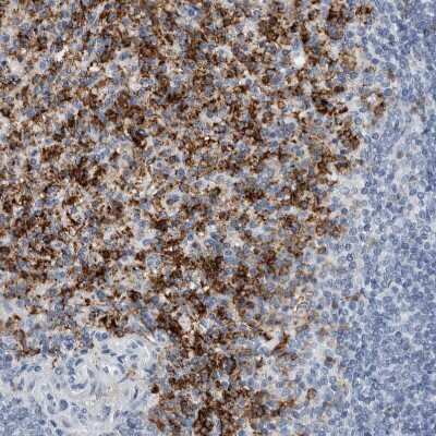 Immunohistochemistry-Paraffin: FCER1G Antibody [NBP1-85959]