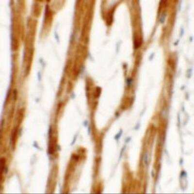 Immunohistochemistry: FCHO2 Antibody - BSA Free [NBP2-81825]