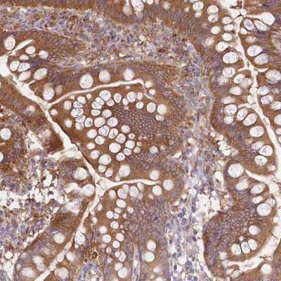 Immunohistochemistry-Paraffin: FCHO2 Antibody [NBP1-90904]
