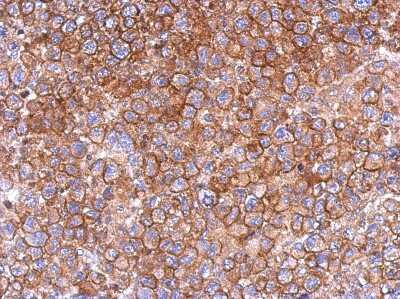 Immunohistochemistry-Paraffin: FCHO2 Antibody [NBP2-16460]