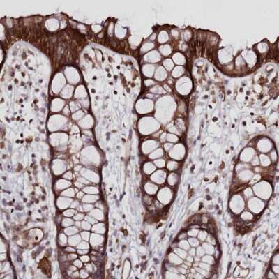 Immunohistochemistry-Paraffin: FCHO2 Antibody [NBP2-32694]