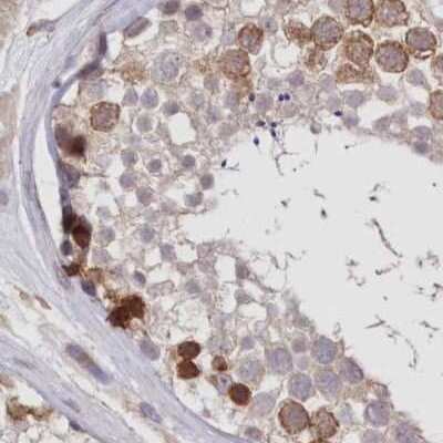 Immunohistochemistry-Paraffin: FCHO2 Antibody [NBP2-32694]