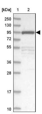 Western Blot: FCHO2 Antibody [NBP2-32694]