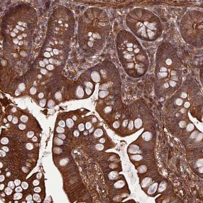 Immunohistochemistry-Paraffin: FCHSD1 Antibody [NBP1-91894]