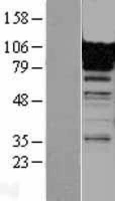 Western Blot: Ficolin-3 Overexpression Lysate [NBP2-04434]