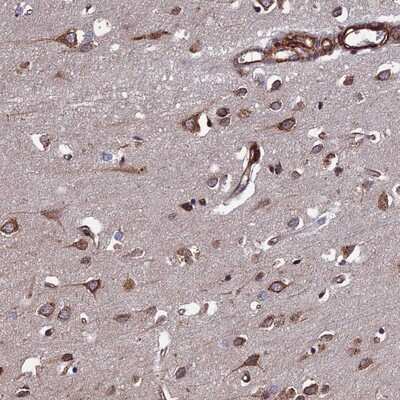 Immunohistochemistry-Paraffin: FCP1 Antibody [NBP1-84704]
