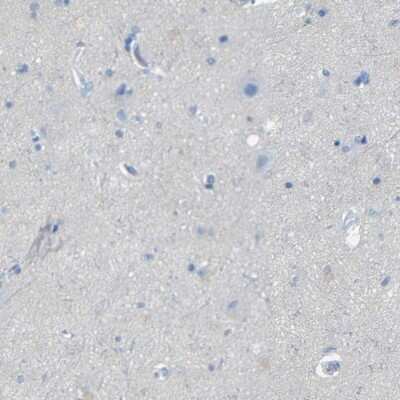 Immunohistochemistry-Paraffin: FCRL1/FcRH1 Antibody [NBP1-84703]