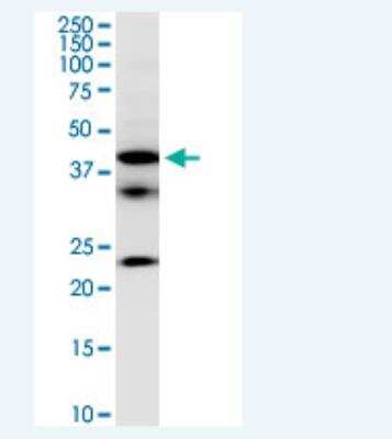 Western Blot: FCRLB/FCRY Antibody (2F8) [H00127943-M01-100ug]