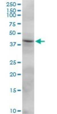 Western Blot: FCRLB/FCRY Antibody [H00127943-B01P]