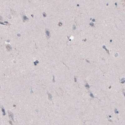 Immunohistochemistry-Paraffin: FCRN/FCGRT Antibody (CL3640) [NBP2-61627]