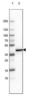 Western Blot: FCRN/FCGRT Antibody (CL3640) [NBP2-61627]