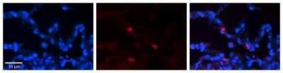 Immunohistochemistry-Paraffin: FCRN/FCGRT Antibody [NBP1-59061]