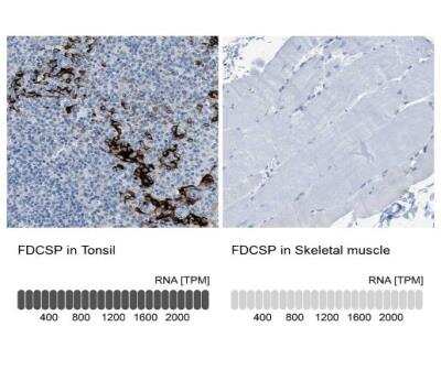 Immunohistochemistry-Paraffin: FDCSP Antibody [NBP1-84702]