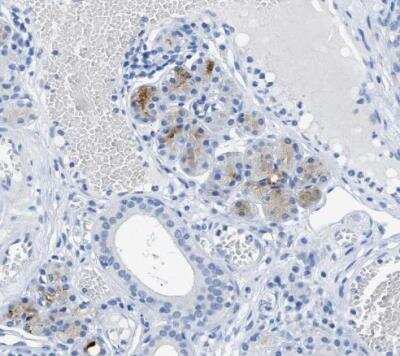 Immunohistochemistry-Paraffin: FDCSP Antibody [NBP1-84702]