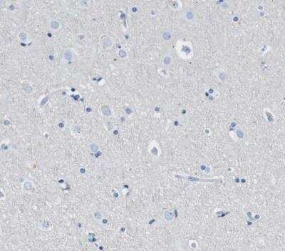 Immunohistochemistry-Paraffin: FDCSP Antibody [NBP1-84702]