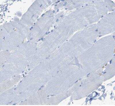 Immunohistochemistry-Paraffin: FDCSP Antibody [NBP1-84702]