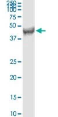 Western Blot: FDFT1 Antibody (3C2) [H00002222-M01]