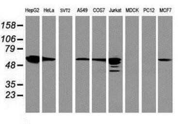 Western Blot: FDFT1 Antibody (OTI2F10)Azide and BSA Free [NBP2-70715]