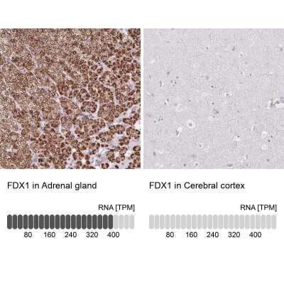 Immunohistochemistry-Paraffin: FDX1 Antibody [NBP2-38946]