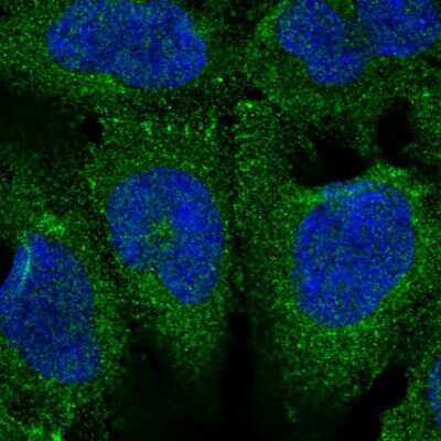 Immunocytochemistry/ Immunofluorescence: FE65 Antibody [NBP2-48682]