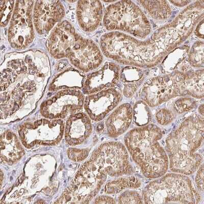 Immunohistochemistry-Paraffin: FE65 Antibody [NBP2-48683]
