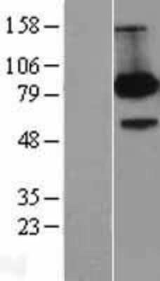 Western Blot: FE65 Overexpression Lysate [NBL1-07590]