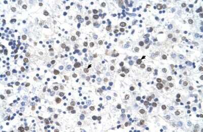 Immunohistochemistry-Paraffin: FECH Antibody [NBP1-54863]