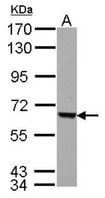 Western Blot: FEM1C Antibody [NBP2-14955]