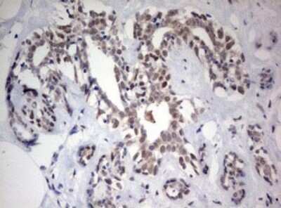 Immunohistochemistry: FEN-1 Antibody (OTI1F3) [NBP2-45640]