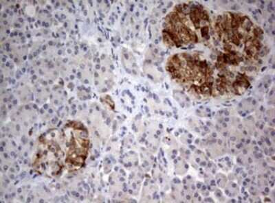Immunohistochemistry: FEN-1 Antibody (OTI1F3) [NBP2-45640]