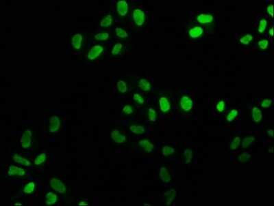 Immunocytochemistry/ Immunofluorescence: FEN-1 Antibody (4D9) [NBP3-15190]