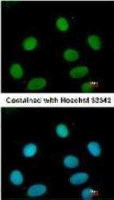 Immunocytochemistry/ Immunofluorescence: FEN-1 Antibody (4E7) [NB100-150]