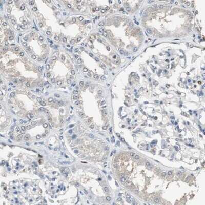 Immunohistochemistry-Paraffin: FEN-1 Antibody [NBP1-84697]